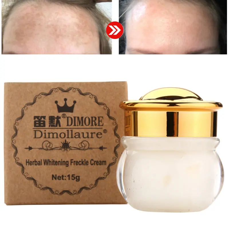 strong acne spot treatment
