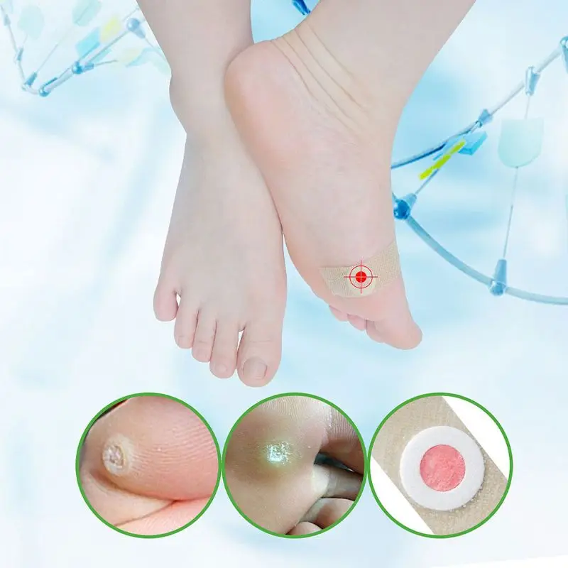 Foot Corn Remover Patch Wart Thorn Curative Calluses Soft Feet Pain Relief Skin Treatment Medical Plaster Sticker Care Tool