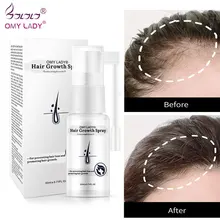 Spray para el crecimiento del cabello para hombres y mujeres, aceite esencial líquido, tratamientos para el cuero cabelludo, reparación de la regeneración del cabello seco, productos Anti pérdida de cabello