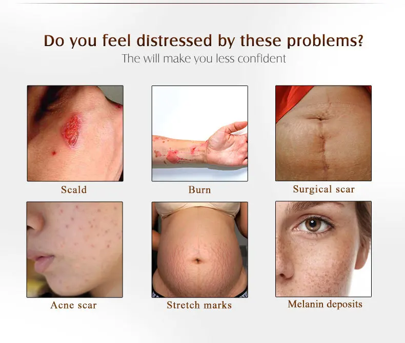 scar-ance-removal-gel_03