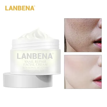 

LANBENA Snail Repair Whitening Facial Cream Day Cream Anti Wrinkle Anti Aging Acne Treatment Moisturizing Firming Skin Care 30g