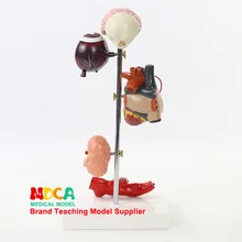 Анатомия органов человека диабет патологическая модель повреждения артерии обучение медицине Mmnxt008