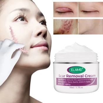 

Recommend Facial Scar Cream Desalination Repair Scars Scarless Operation Scald whitening Cream