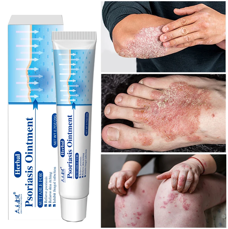 Antibacterial Cream Psoriasis Herbal Treatment Eczema Anti-itch Relief Rash Urticaria Desquamation Ointment Body Skin Care |