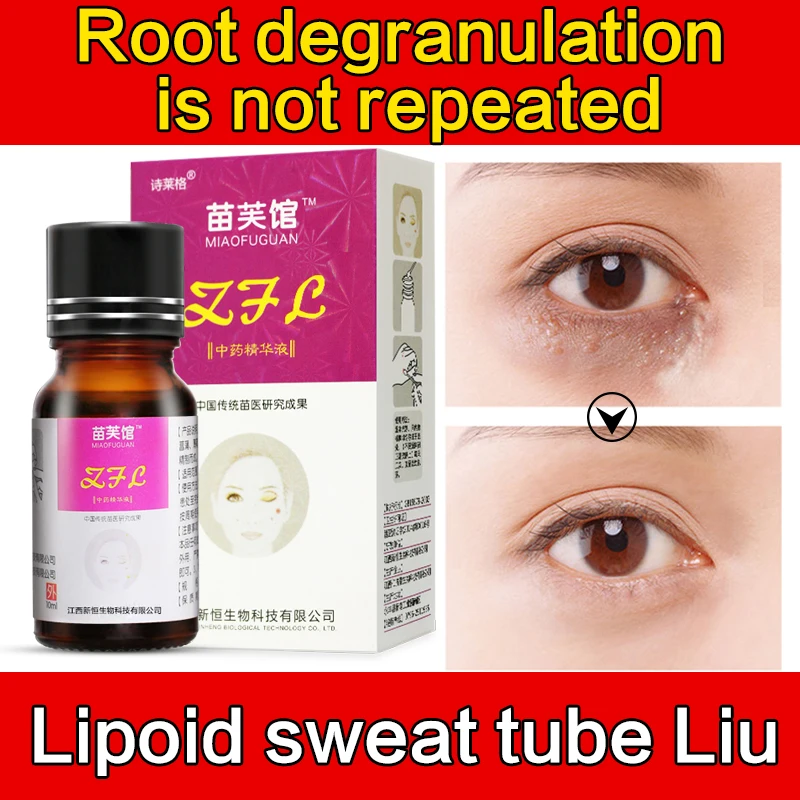 Антивозрастная увлажняющая отбеливающая Сыворотка для кожи вокруг глаз 10