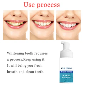 

Soda Foam Toothpaste Stain Removal Whitening Fight Bleeding Gums Bathroom M88