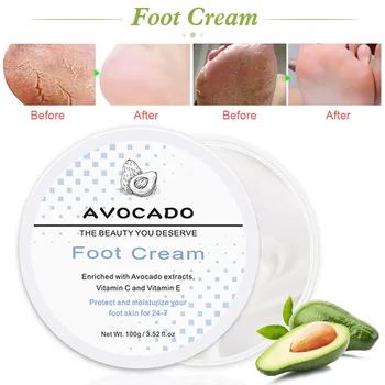 

Foot Cream Avocado Moisturizing Hand Lotion for Dry Cracked Foot, 3.5 oz.