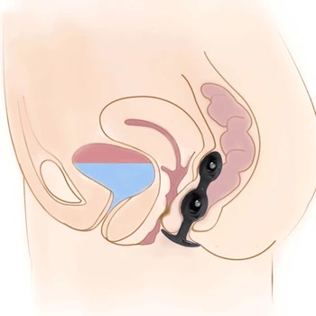 Metal Anal Ball Butt Plug Anal Beads Plug Anus Vagina Massager Prostate Stimulator Masturbator anal tail Sex Toy For Men Women 3