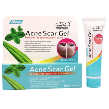 

Green Tea Aloe Face Removal Cream Acne Scar Gel Treatment Acne Scar Gel Mark Removal Cream Skin Care 35ml TSLM1