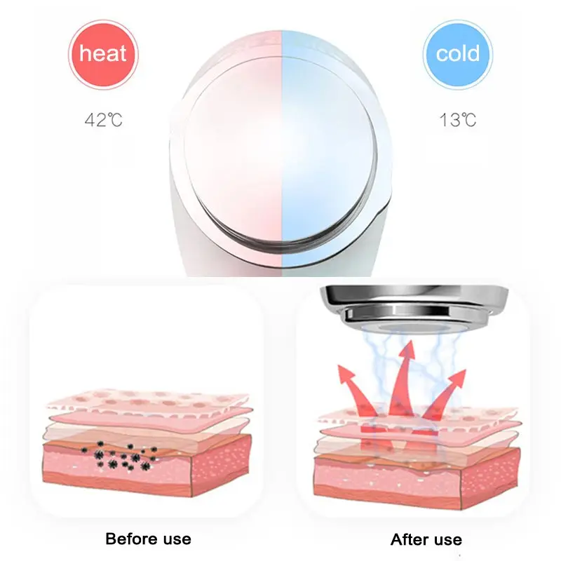 Hot and cold iontophoresis facial beauty ion rejuvenation cleansing cleansing household beauty instrument