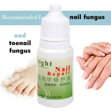 Травяной Антибактериальный раствор для ногтей, эффективное лечение, стерилизация, средство для удаления грибка ногтей, горячая распродажа