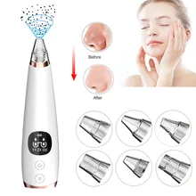 Средство для удаления угрей вакуумный аппарат для очистки пор средство для подтяжки лица массажное средство для удаления прыщей экстрактор черных точек инструмент для ухода за кожей