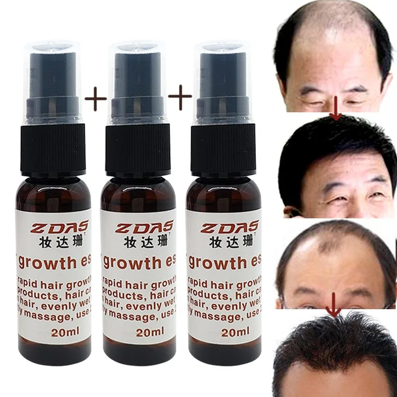 3bottle Hair Loss Chinese Herbal Polygonum l germinal dense hair liquid medicine fast hair growth agent seborrheic essential