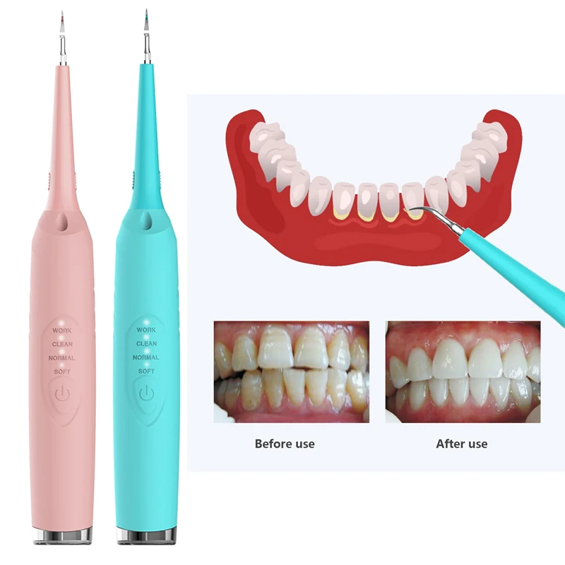 Electric Dental Calculus Plaque Remover Teeth Whitening Scale Tooth Cleaner Dentist Home Use Scaler Drop ship |