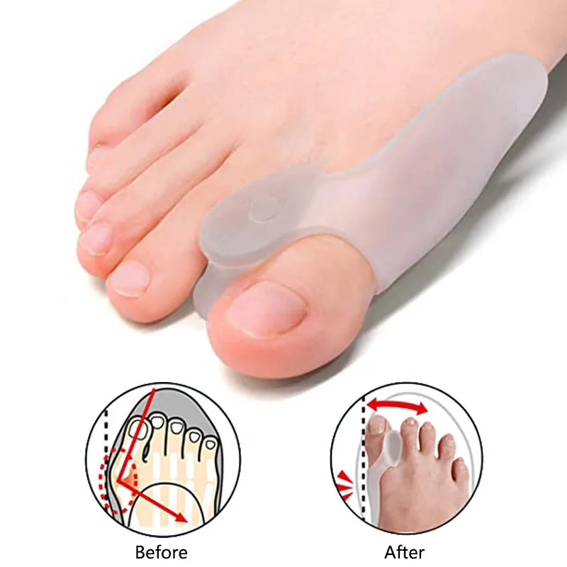2pcs Hallux Valgus Corrector Pad Silicone Finger Toe Separator Relieve Bunion Pain Big Toe Straightener Adjuster Foot Care Tool