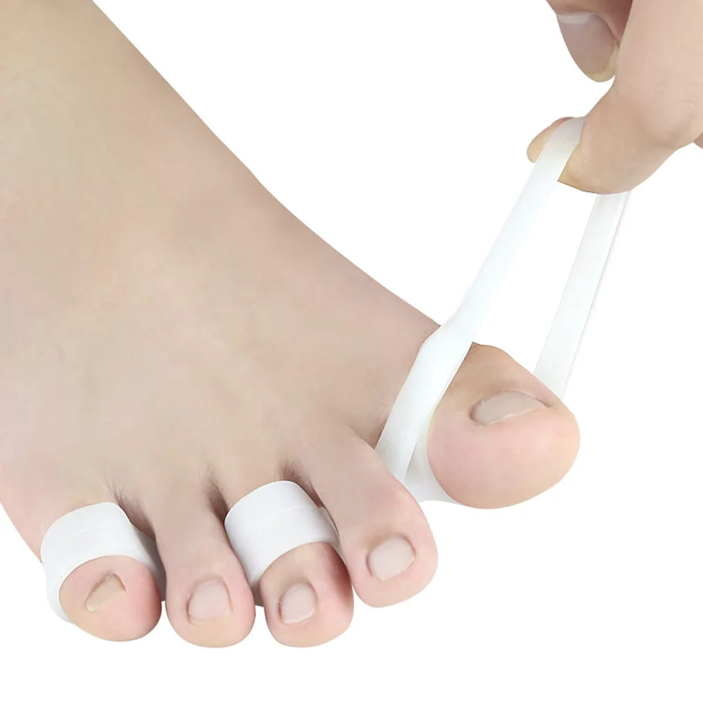 1 пара корректор для большого пальца стопы, выпрямитель для пальцев ног, естественное лечение боли, вальгусная деформация пальцев, Выпрямители для суставов, облегчение боли