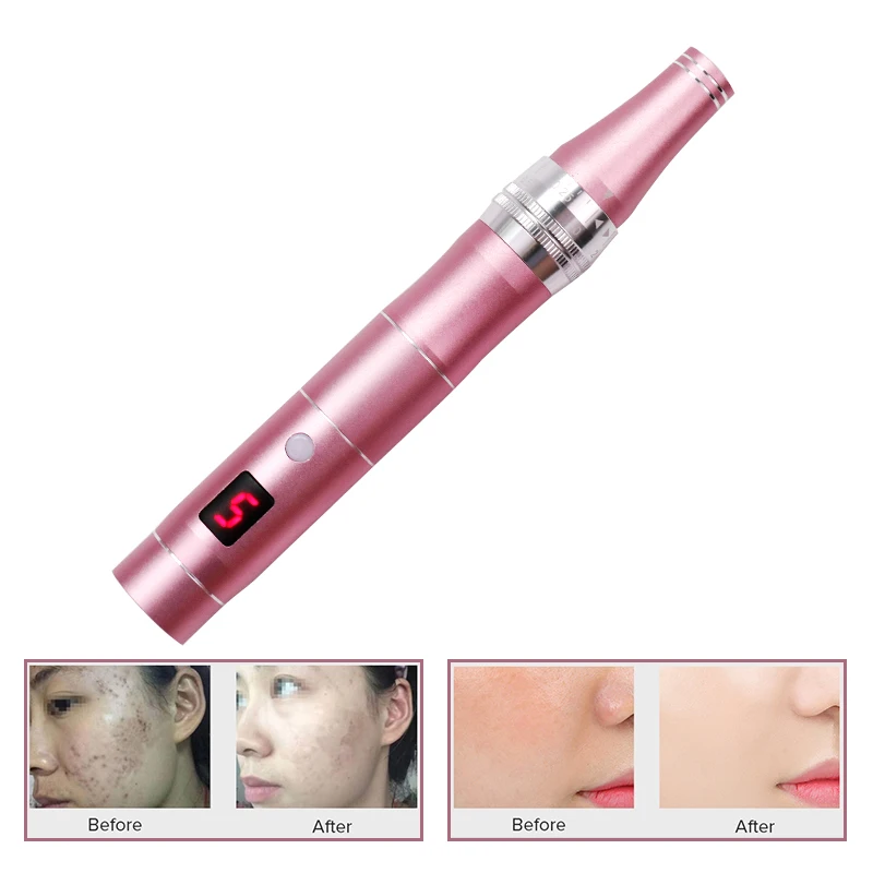 LCD Screen 5 Levels Micro Tiny Needles Dr. pen MYM Tightening Remove Scar Reduce Skin Wrinkles Scar Stretch Marks Removal Device