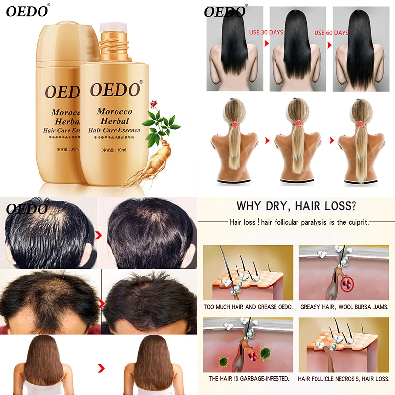 30 мл OEDO бренд Уход за волосами Марокко EssenceHair Сыворотка для роста волос