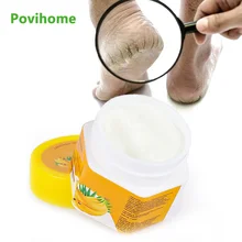 1 pçs 20g óleo de banana natural removedor de pele morta reparação rápida creme de pé cuidados com a pele produto anti secagem crack forte creme eficaz
