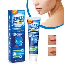 

60g Warts Remover Ointment Wart Treatment Antibacterial Cream Skin Tag Removal Herbal Plaster Relief Corn Wart Oil Care Ointment
