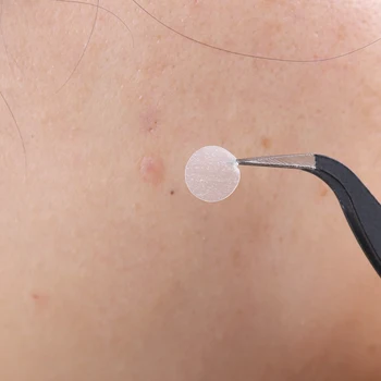 

36PCS Hydrocolloid Acne Invisible Pimple Patch Skin Tag Removal Patch Pimple Blackhead Blemish Removers Facial Care Tool