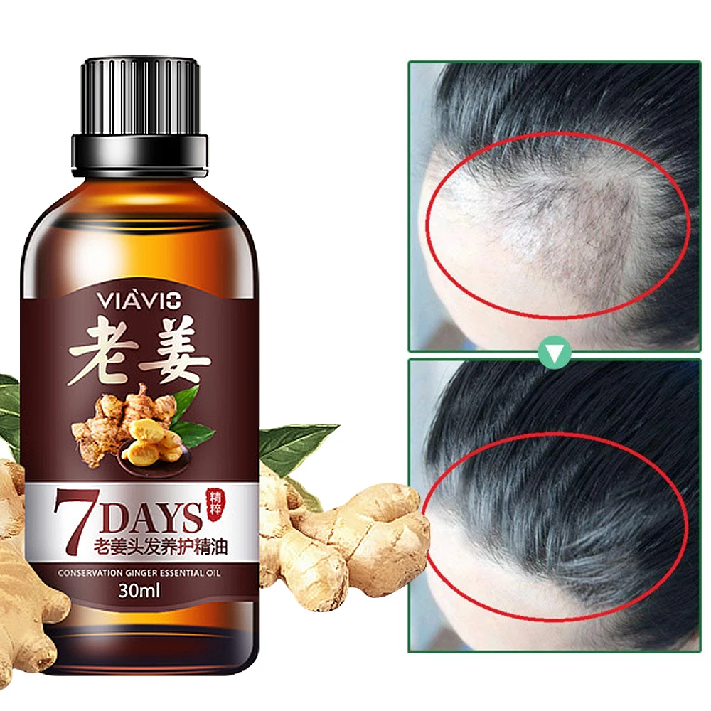 

Hair Growth Essence Oil Ginger Hairdressing Hair Mask Anti Hair Loss Liquid Effective Fast Growth Beauty Dense Hair Growth Serum