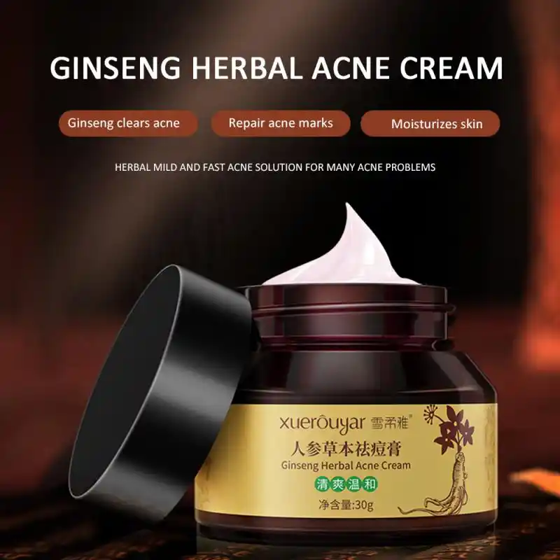 herbal acne cream