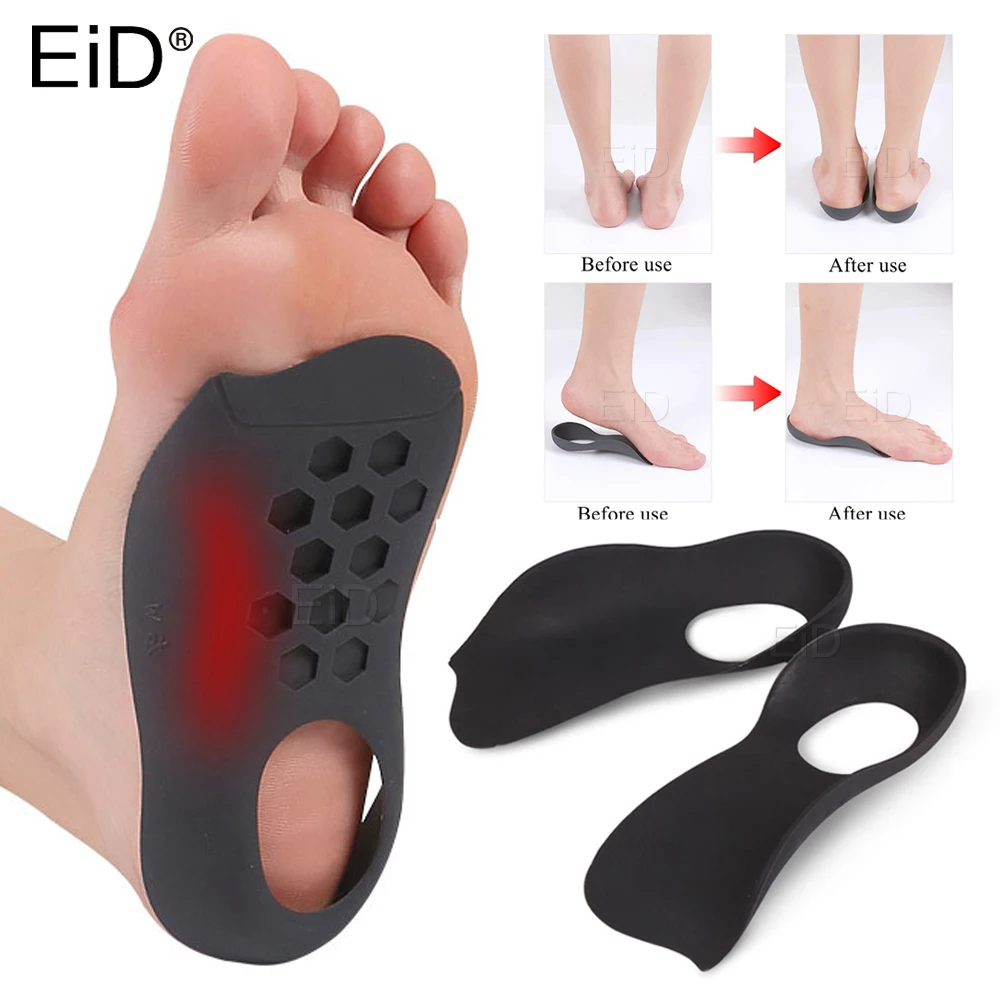 Xo-Benen Orthopedische Inlegzolen Orthotics Platte Voet Gezondheid Zool Pad  Voor Schoenen Insert Steunzool Pad Voor Fasciitis Plantaris voeten Zorg -  AliExpress