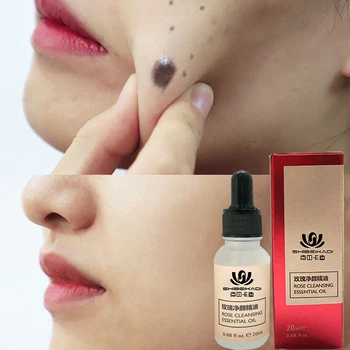 

20ML Mole & Skin Tag Repair Solution Painless Mole Skin Dark Spot Repair Face Wart Tag Freckle Repair Cream Oil D086