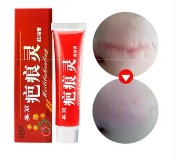 

60G Snake Oil Repair Scar cream Removal Acne Scars gel Stretch Marks Surgical scar Burn For Body Pigmentation Corrector care