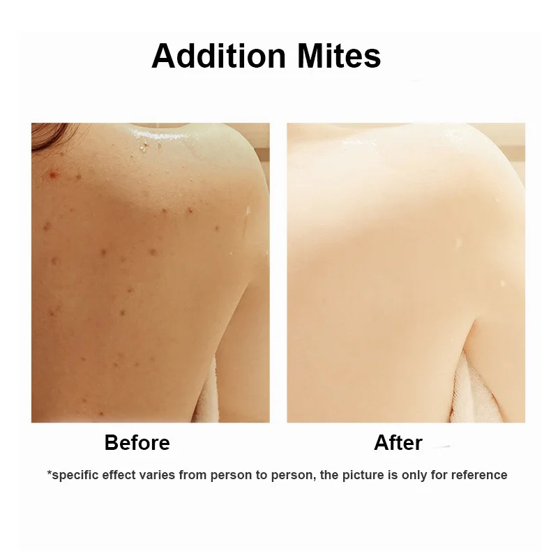 1pc/100g Remove Mites Soap Body Face Skin Oil Control Fresh Clean Soap Acne Care Herbal Ingredien Skin Care Sell Well In China