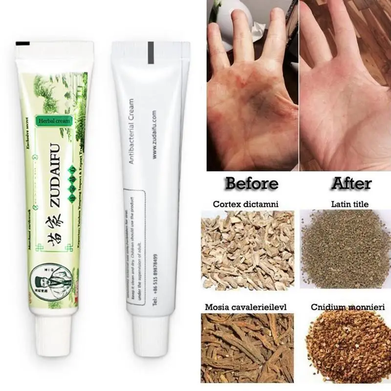 мазь 29а таиланд. экзема кожи мазь. крем мазь от экземы на руках. мазь от псориаза и дерматита. крем китайский zudaifu.