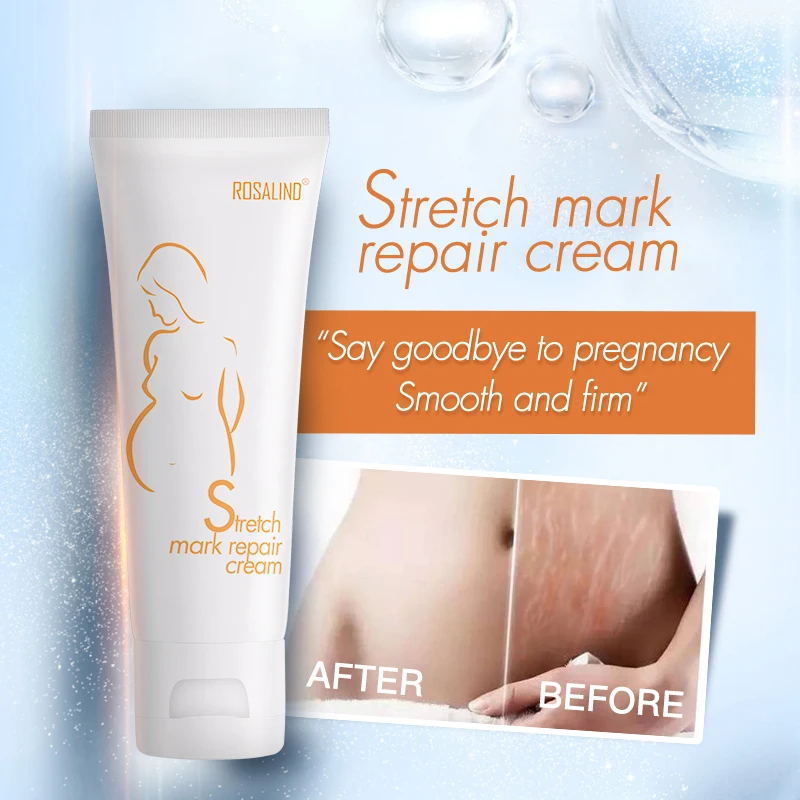 

ROSALIND Maternity Body Pregnancy Cream Scar Removal Cream For Treatment Maternity Repair Body Effective Stretch Marks Cream