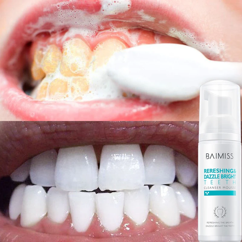 New Fresh Shining Tooth-Cleaning Mousse Toothpaste Teeth Whitening Oral Hygiene Removes Plaque Stains Bad Breath Dental Tool