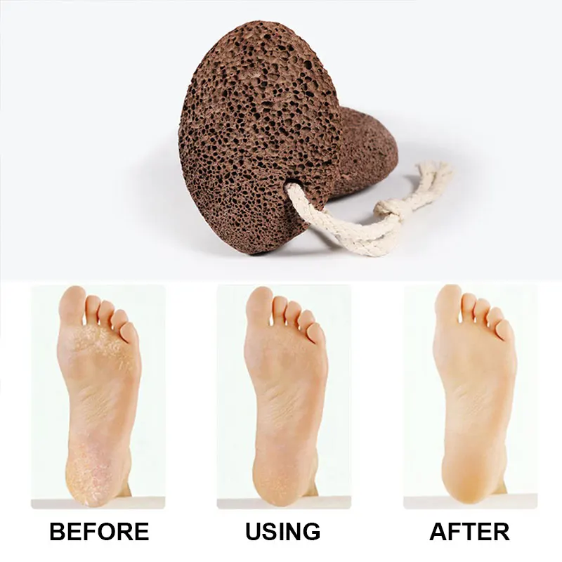 Pumice Stone for Feet Hard Skin Callus Remover Scrubber Home Pedicure Exfoliation WH998