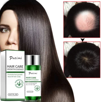 

1pc Putimi Hair Growth Serum Prevent Hair Loss Fast Growth Essence Natural Hair Growing Serum Restoration Essence Thicken TSLM1