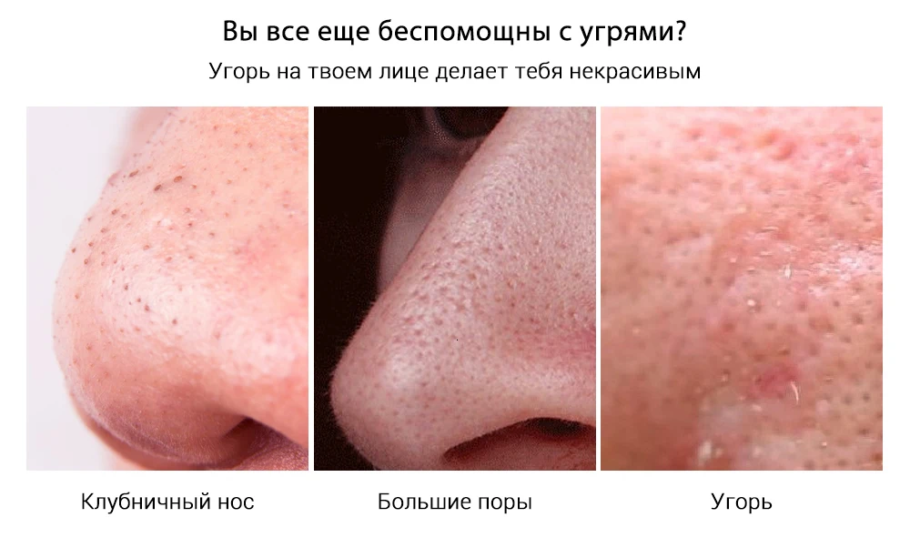 2018 Новый стиль LANBENA для устранения черных точек Нос Маска для очищения пор черная маска пилинг акне лечение Черный глубокое очищение и уход