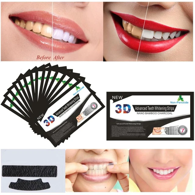 Do Whitening Strips Work? Eagle Harbor Dentist, 51 OFF