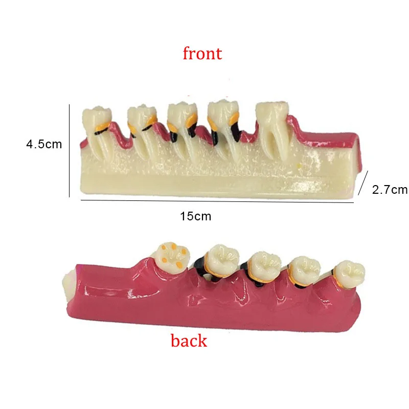 

Dental Periodontal Disease Tooth Model Pathological Teaching Resin Teeth Dentist Communication Dentistry Lab Study TrainingM4010