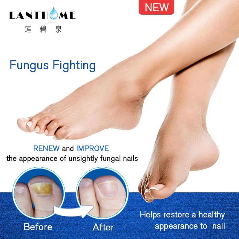 Nail Treatment Pen Onychomycosis Paronychia Anti Fungal Nail Infection Chinese Herbal Toe Fungus CareRepair Serum 10PCS nail fungus treatment nail care oil nail cuticle oil pen nail care kit