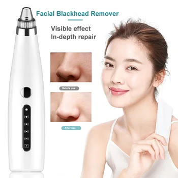 

Skin Care Adjustable Rechargeable Electric USB Home Facial Blackhead Remover Salon Vacuum Pore Cleaner 5 Gears Multifunction