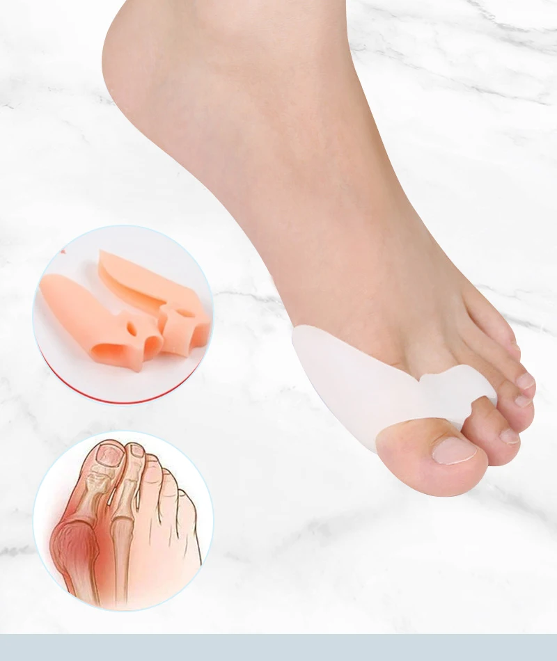 Silikon-Gel-Daumenkorrektor, Hallux-Valgus-Schutz für den kleinen Zeh, Zehenspreizer, Fingerkorrektor, Fußpflege, Schmerzlinderungspolster, Werkzeug – Detail 1