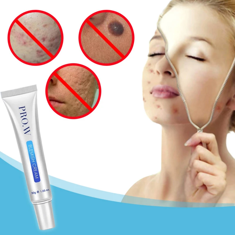 skin blemish removal cream