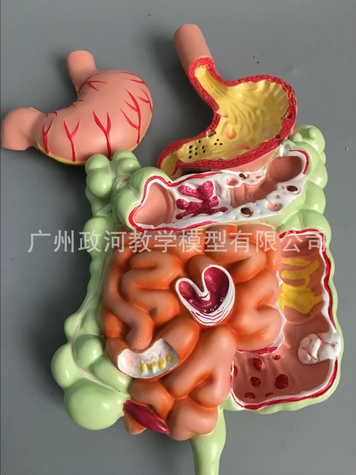 Модель желудка пищевая система человека анатомия большой кишки Cecum прямая кишка