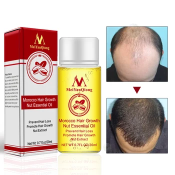 

MYQ Powerful Hair Growth Essence Hair Loss Products Essential Oil Liquid Treatment Preventing Hair Loss Hair Care Products 20ml