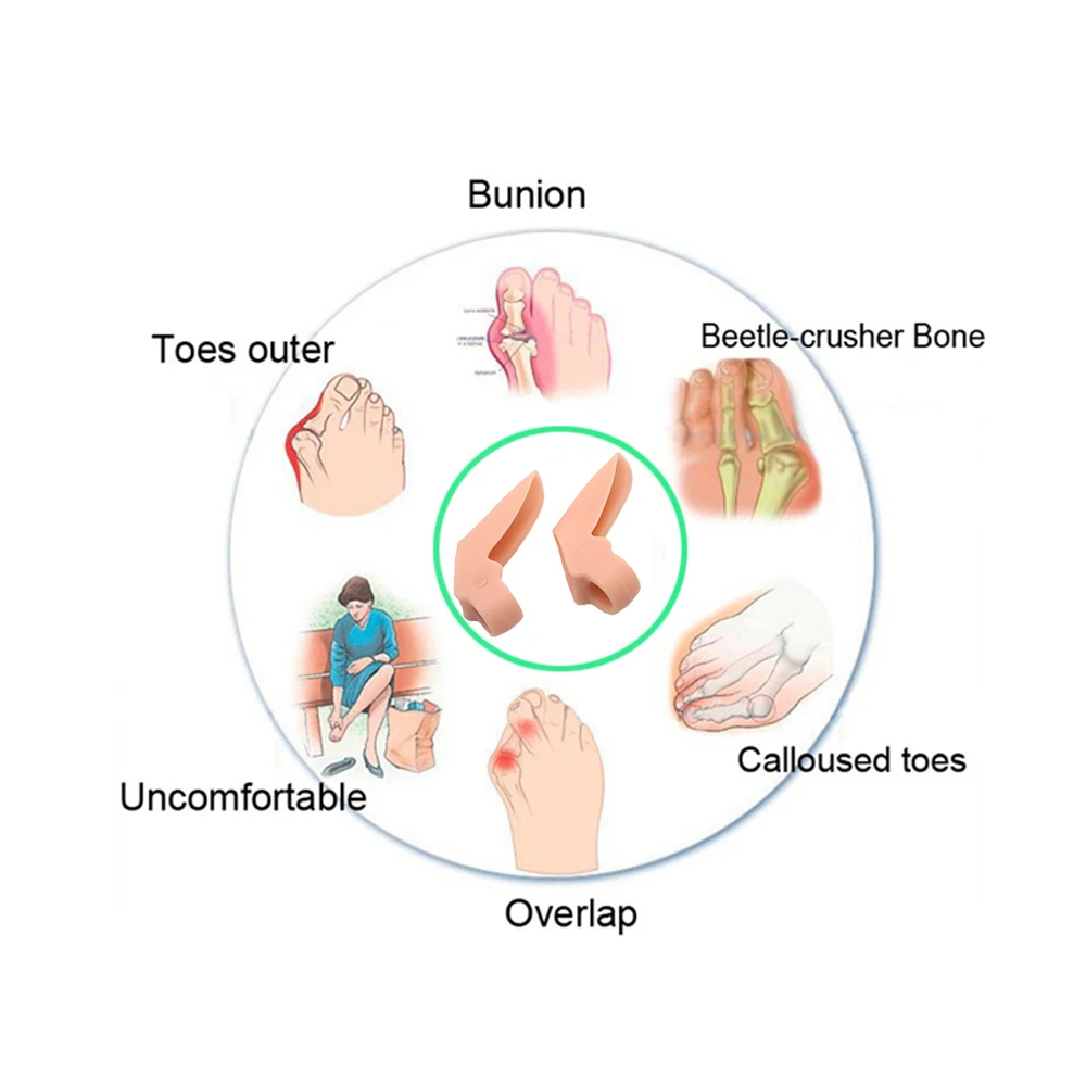 10Pcs Silicone Big Toe Separator Bunion Adjuster Hallux Valgus Toe Straightener Corrector Gel Foot Fingers Pedicure Tool D2222