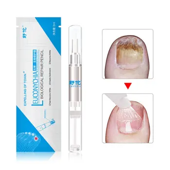 

Film Bioremediation Film Remove Nail Fungus Remove Gray Nail Soft Liquid Non-corrosive No Pain