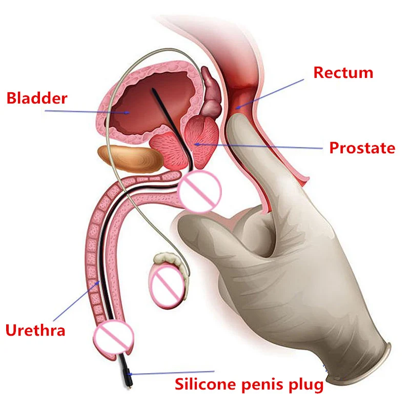 Electro Shock Penis Plug Cock Ring,Electric Stimulation Sex Urethral Toys Urethra Dilator,Male Masturbation Sex Toys Accessories — view 6