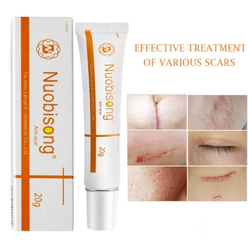 

Nuobisong face skin care treatment face Pimples scar Stretch Marks removal acne treatment whitening Pigmentation Corrector cream