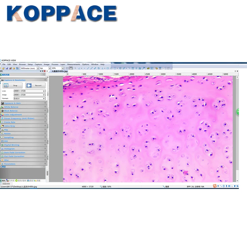 KOPPACE 100X 400X 18 миллионов пикселей USB3.0 Перевернутый Биологический составной